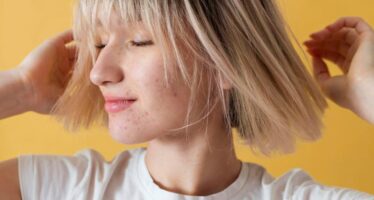 Cum să scapi rapid de acnee: 6 remedii care funcționează
